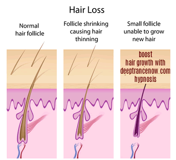 Grow hair with hypnosis
