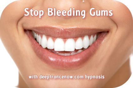 Stop Bleeding Gums hypnosis